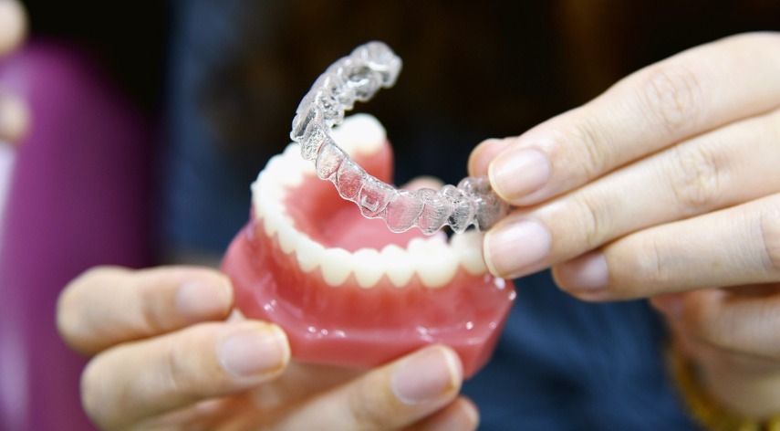 Invisible Clear Aligners For Misaligned Teeth