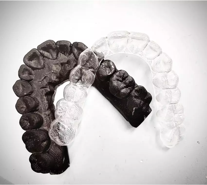 Invisible kristelle klear aligners Treatment In Coimbatore