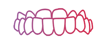 Teeth Aligners In Coimbatore