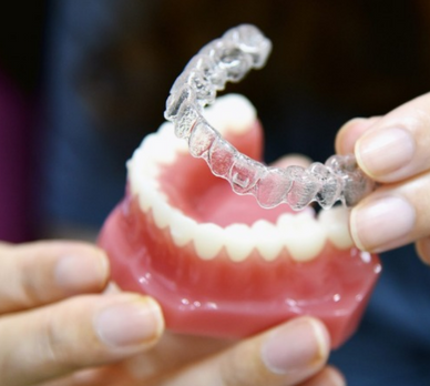 Common Myths & Facts About Invisible Clear Aligners / Braces