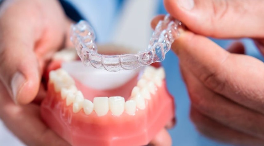 Invisible Clear Aligners for Misaligned/Crooked Teeth