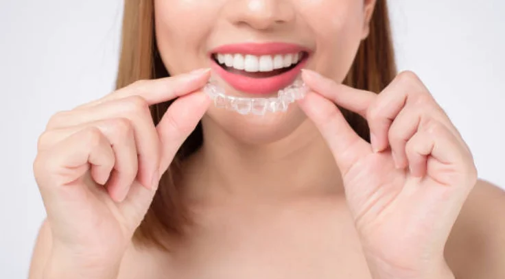 Invisible Clear Aligners for Teeth Straightening