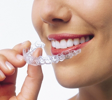 Achieve perfectly aligned teeth with clear aligners in South India for a confident smile.