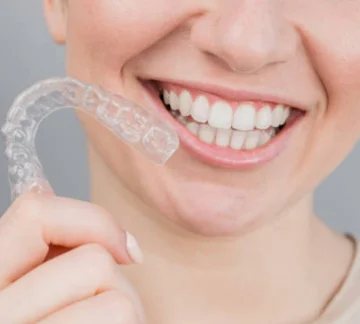 10 Aftercare Tips For Clear Aligners Treatment For Best Results