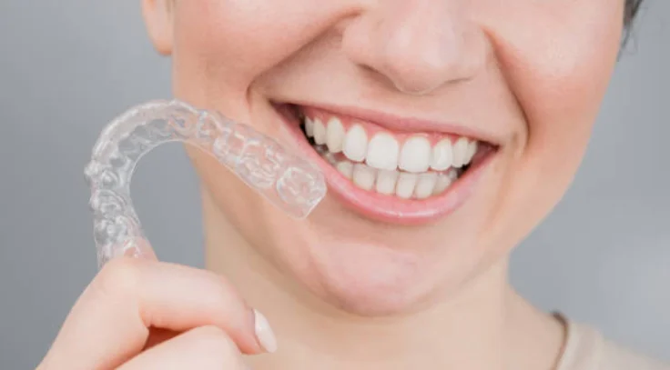 Invisible Clear Aligners for Teeth Straightening