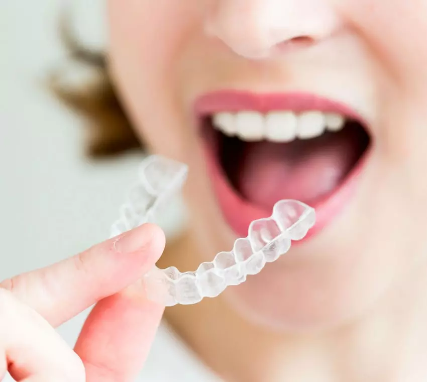 kristelle klear aligners teeth straightening In Tamil Nadu