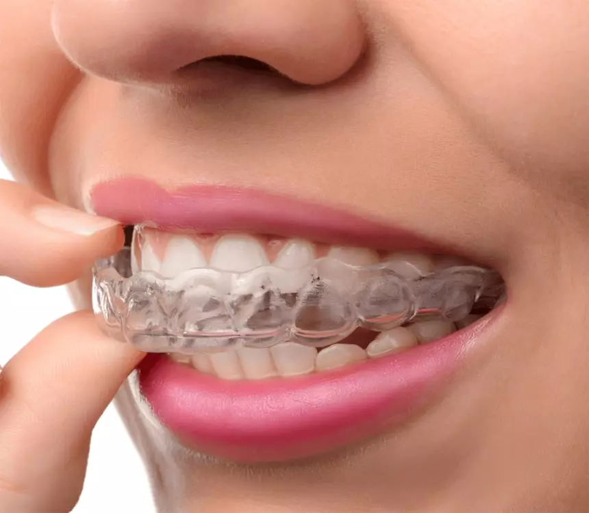 Teeth Sapce Fixing In Coimbatore